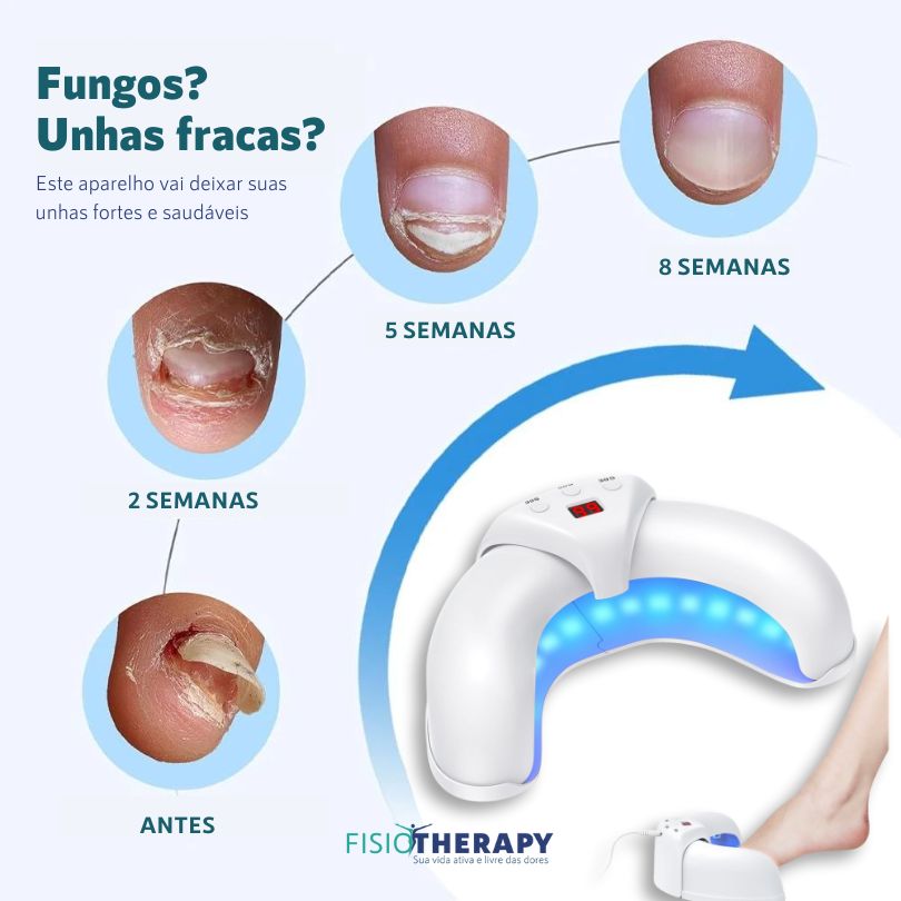 ARTICure - terapia ortopédica para joelhos