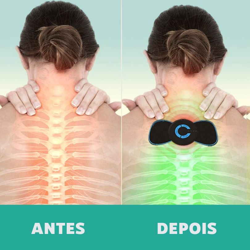 ARTICure - terapia ortopédica para joelhos